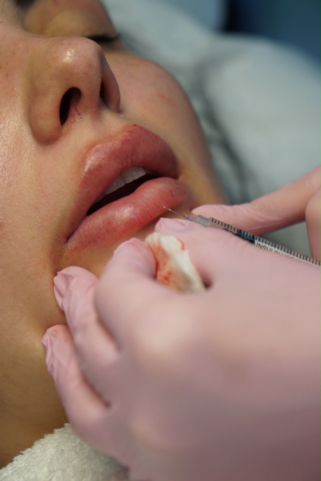 Luxury skincare treatment