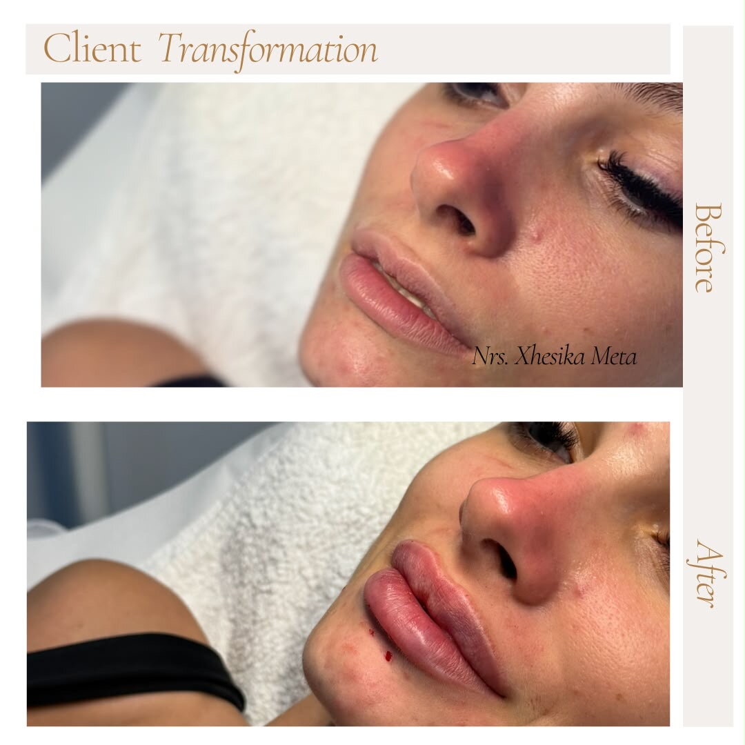 After treatment