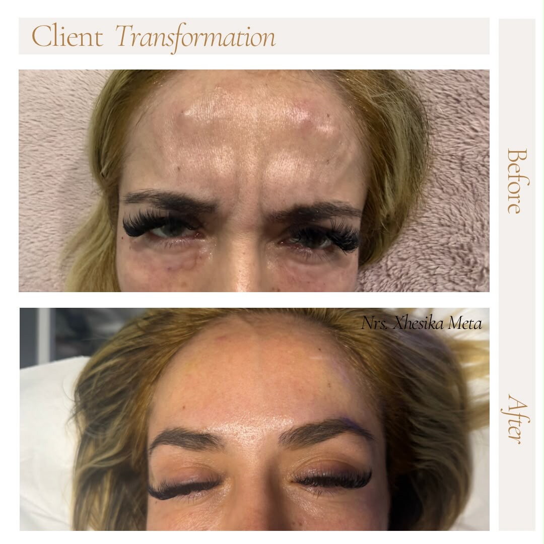 Before treatment