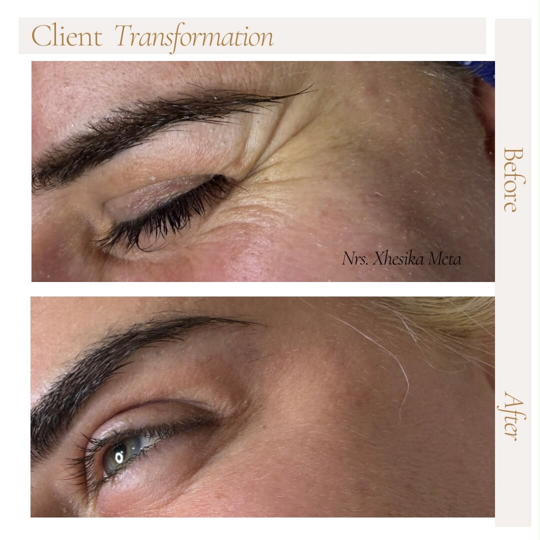 Before treatment