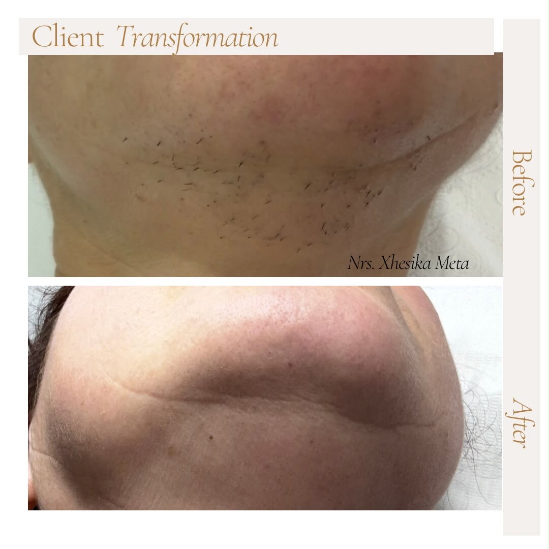 After treatment