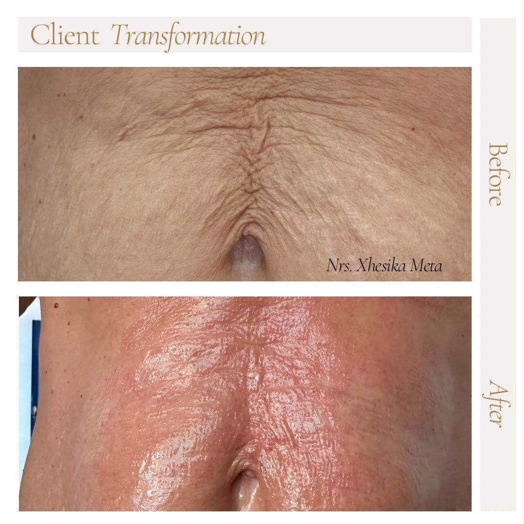Before treatment
