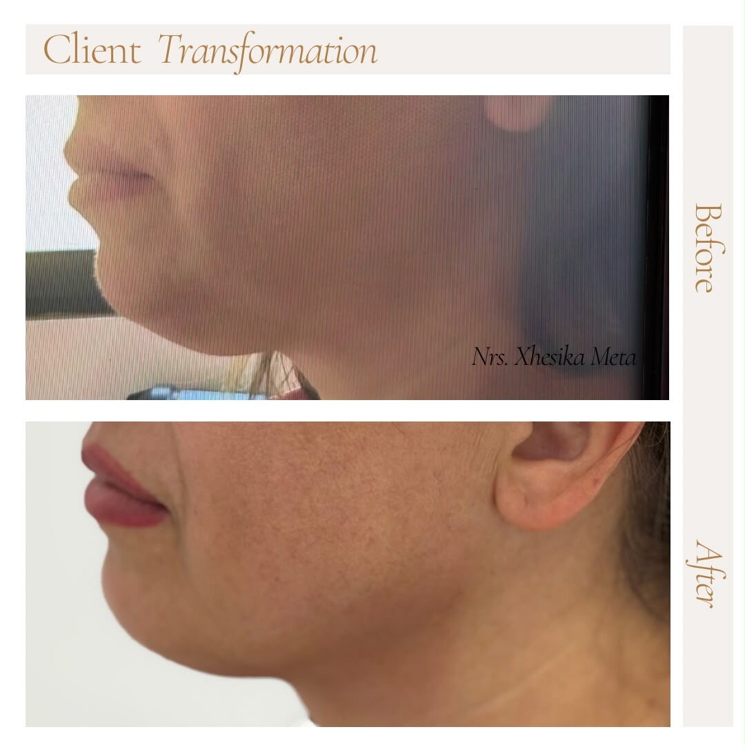 After treatment